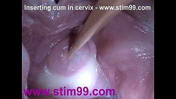 Insertion Semen Cum in Cervix Wide Stretching Pussy Speculum