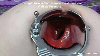 DGG both holes extreme opening with speculum